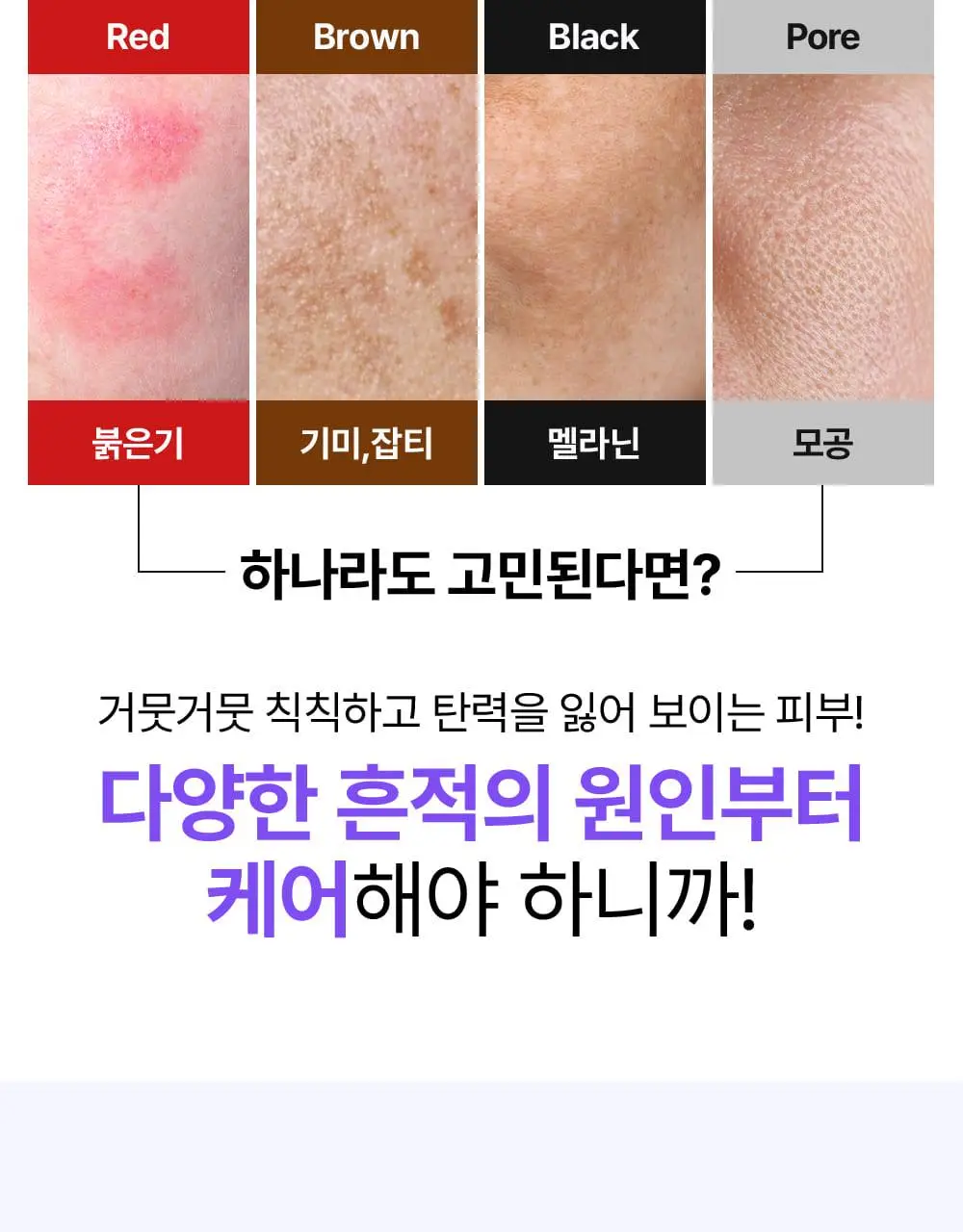 [나띠PICK][잡티케어] 더마펌 수딩 리페어 토닝 세럼 R4 30ml 기획 (+리필 30ml) 상세페이지 12